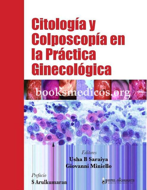 Citología y Colposcopía en la Practica Ginecologíc