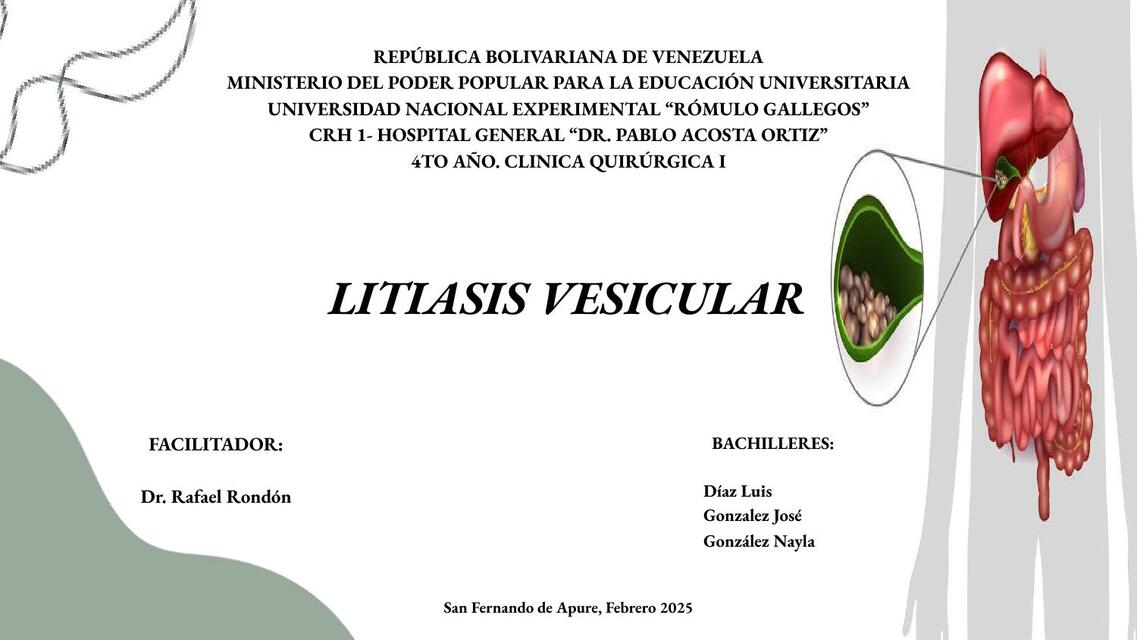 LITIASIS VESICULAR PPTX