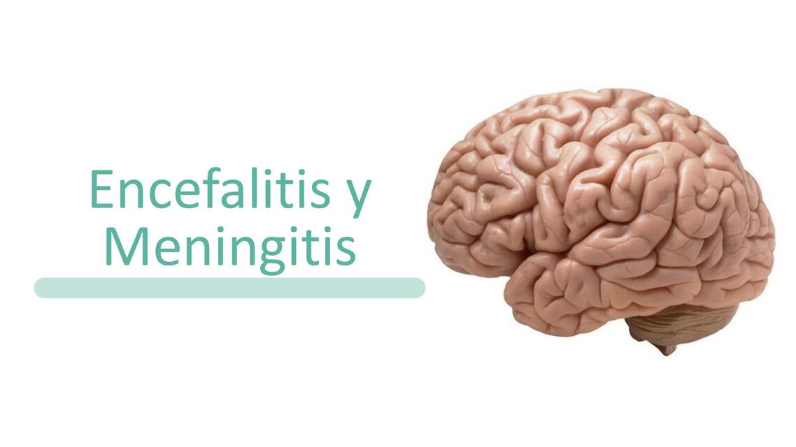 Meningitis y Encefalitis