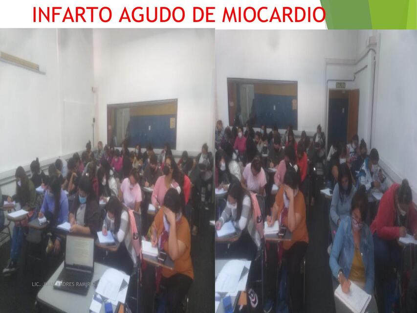 Infarto Agudo de Miocardio 1