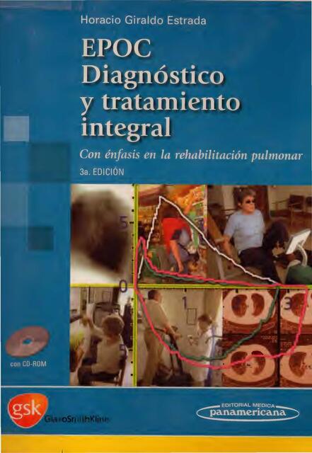 EPOC DIAGNOSTICO Y TRATAMIENTO INTEGRAL G ESTRADA