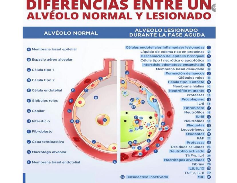 Diferencias entre un alveolo sano y uno lesionado