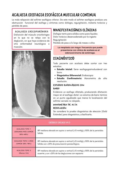 ACALASIA