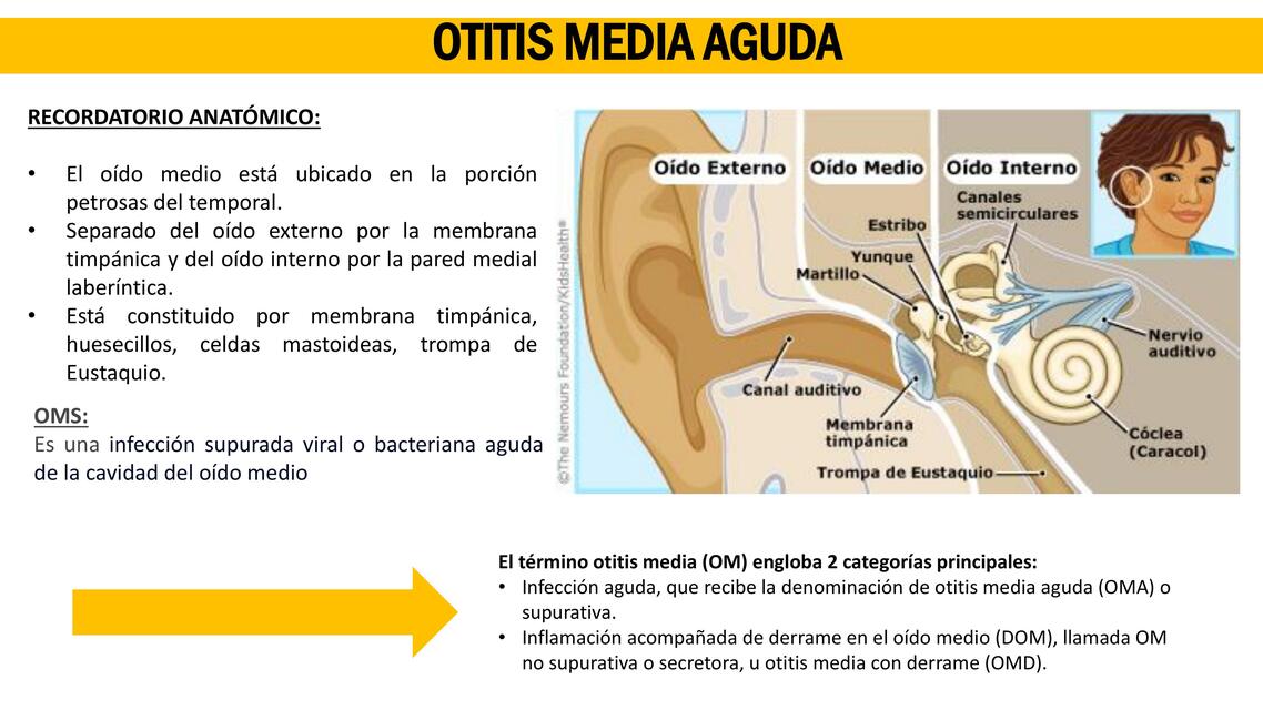 OMA SINUSITIS AGUDA