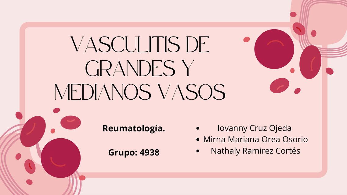 Vasculitis de medianos y grandes vasos