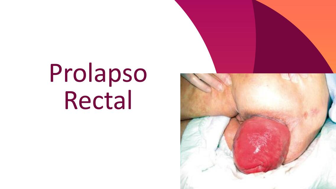 Presentación Prolapso Rectal