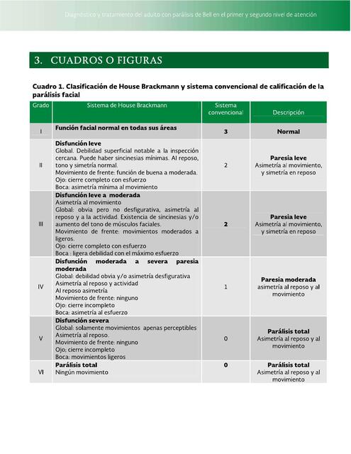 PARALISIS FACIAL