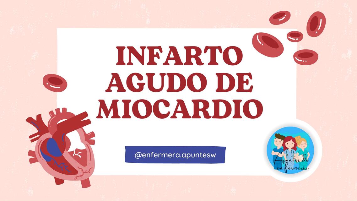 INFARTO AGUDO DE MIOCARDIO ANGINA INESTABLE pptx