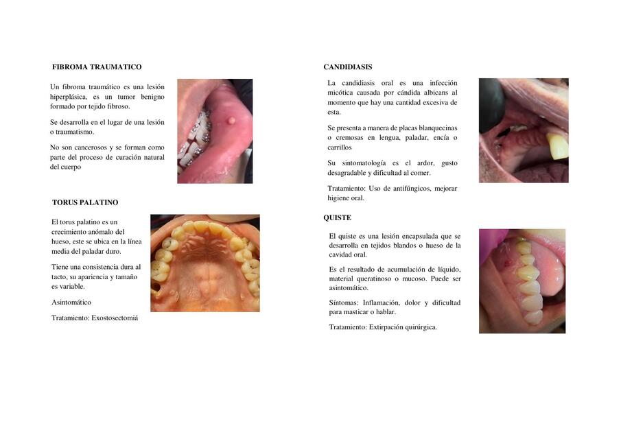 lesiones de la cavidad oral