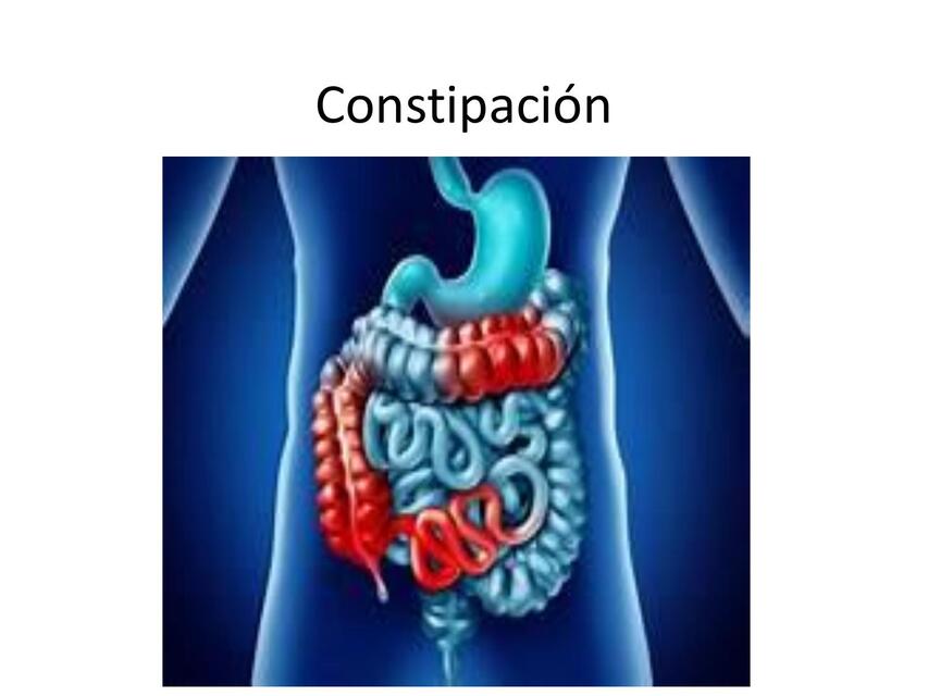 CONSTIPACIÓN