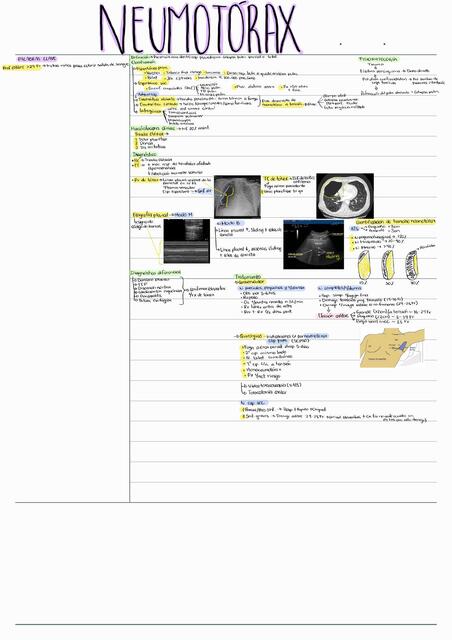 Neumotorax - Cornell resumen