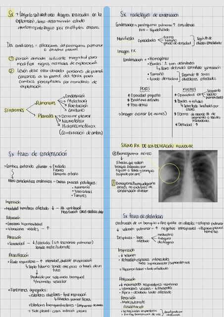 SX PLEUROPULMONARES - Resumen