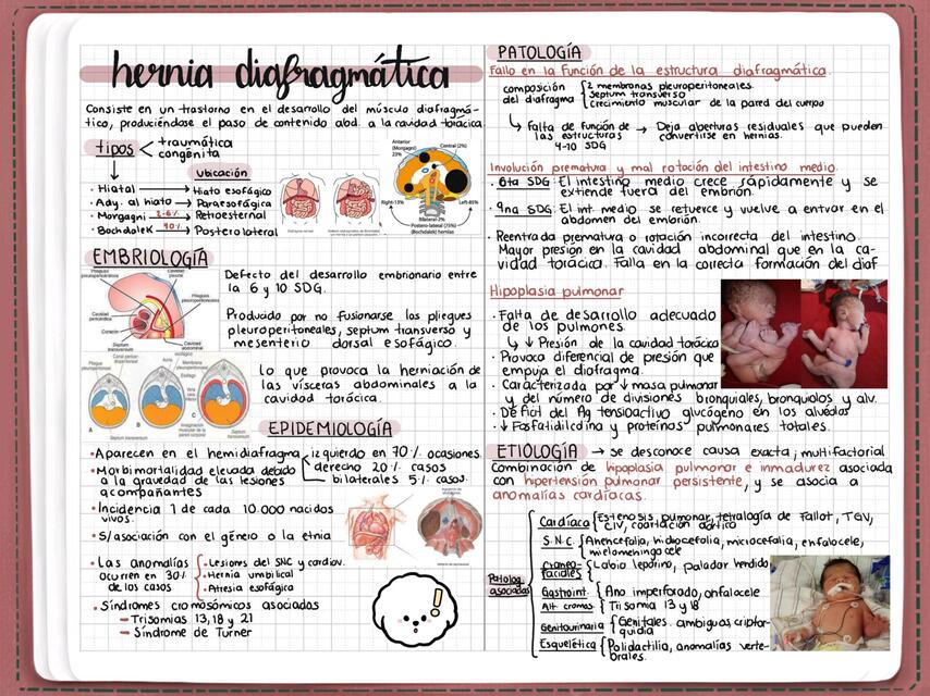 Hernia diafragmática