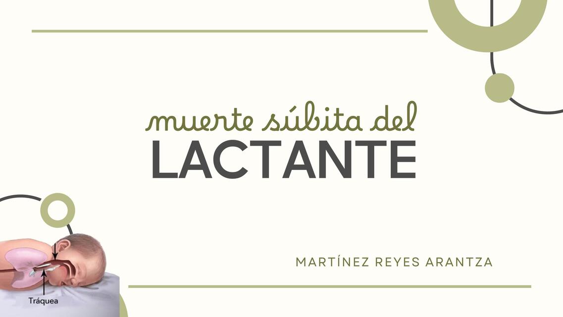 muerte súbita del lactante