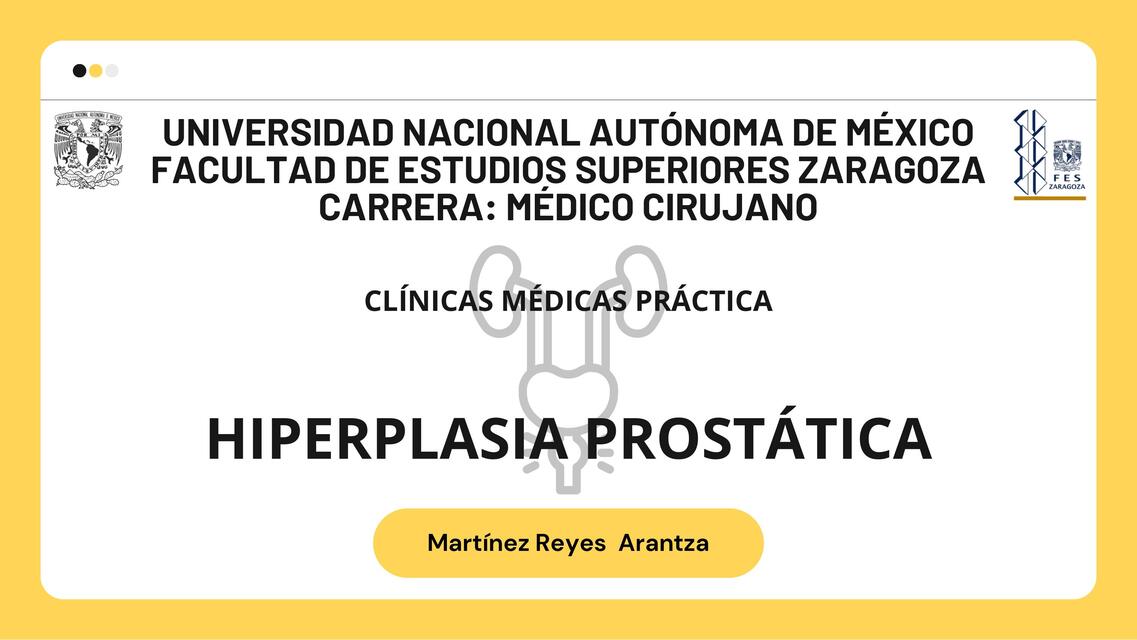 hiperplasia prostática