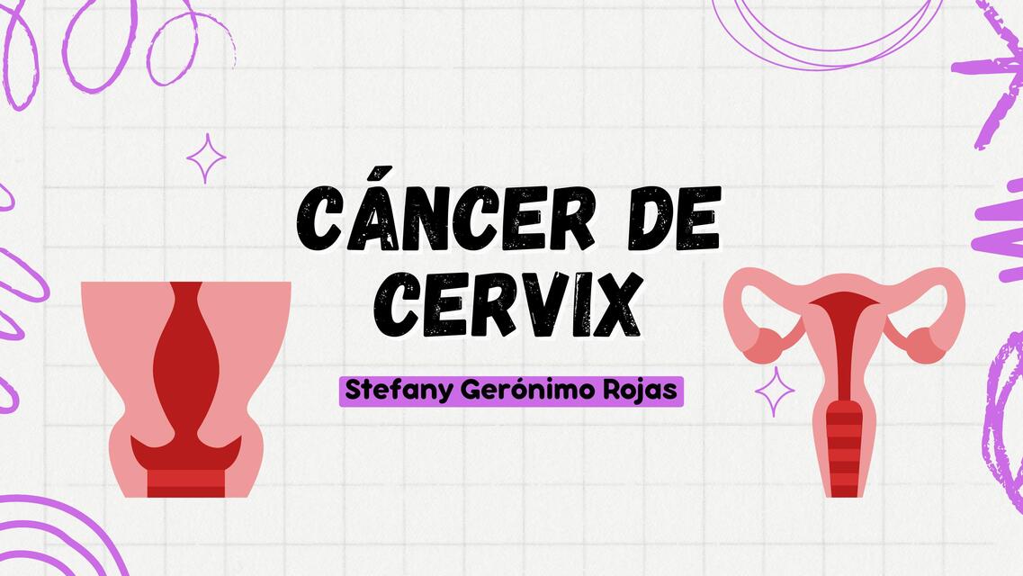 Cáncer de cervix