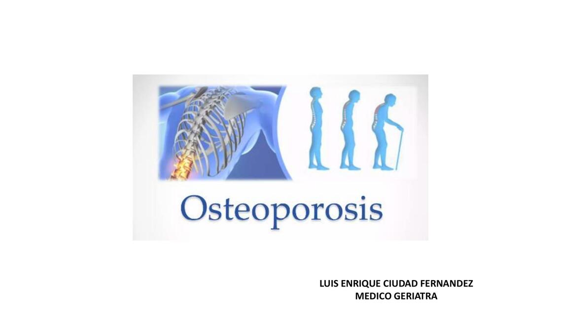 OSTEOPOROSIS