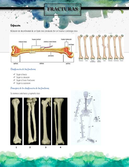 Fracturas