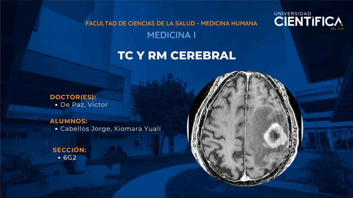 TC Y RM DE CEREBRO