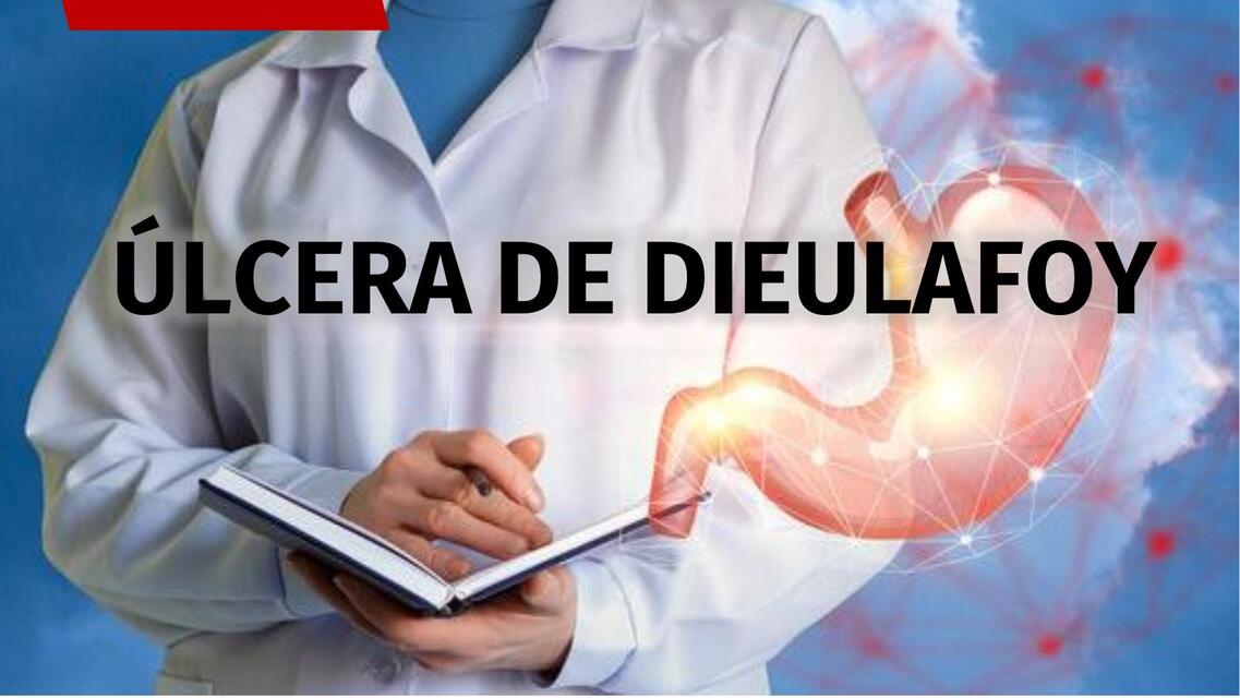 ÚLCERA DE DIEULAFOY