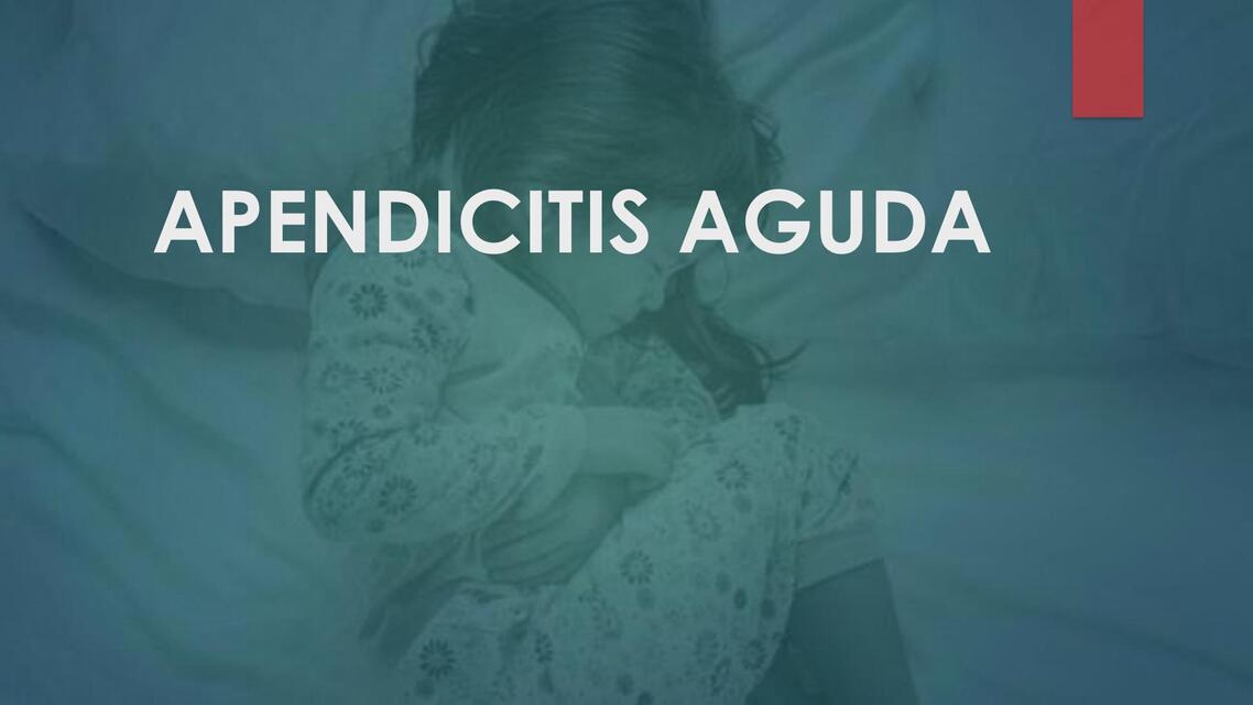 26 APENDICITIS AGUDA