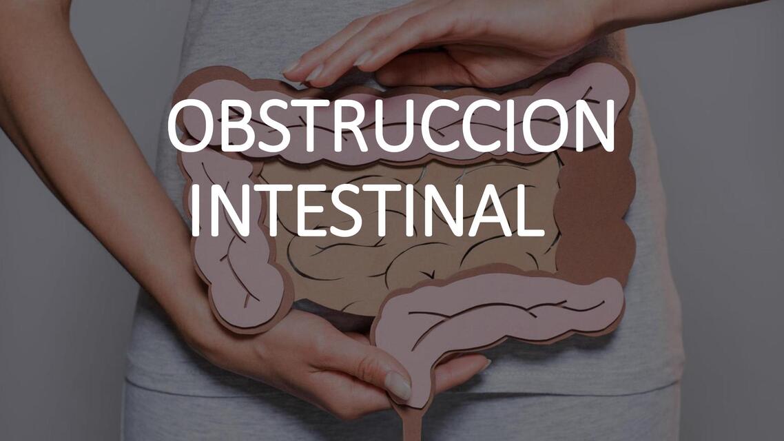 29 OBSTRUCCION INTESTINAL Y PSEUDO OBSTRUCCION