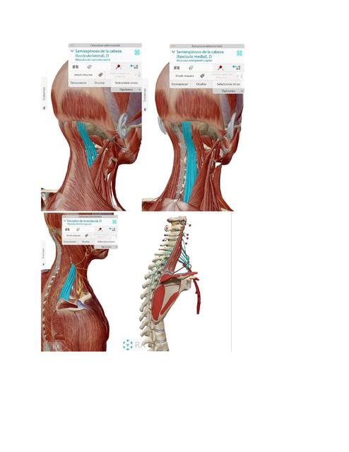 Imágenes Músculos del cuello 