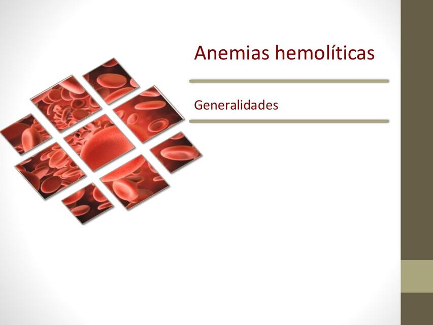 anemias hemolíticas