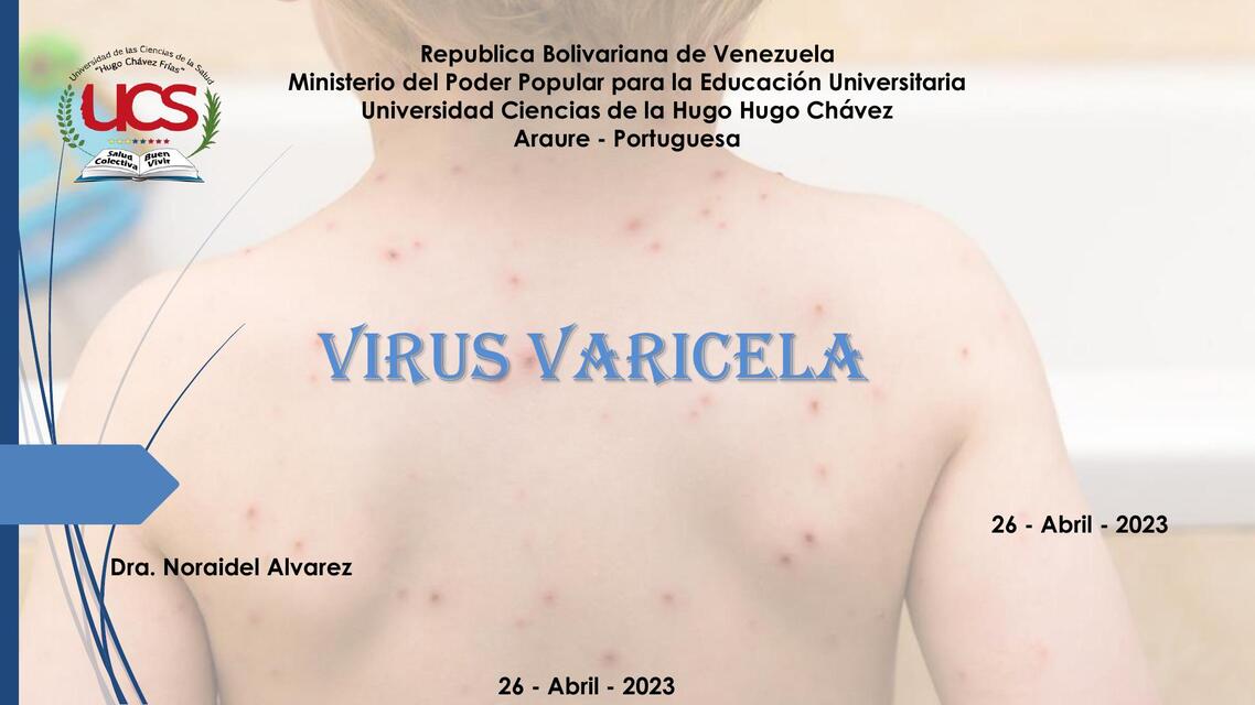 Varicela