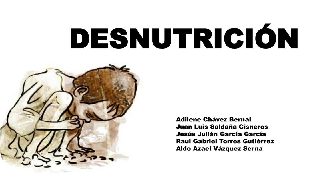 DESNUTRICION