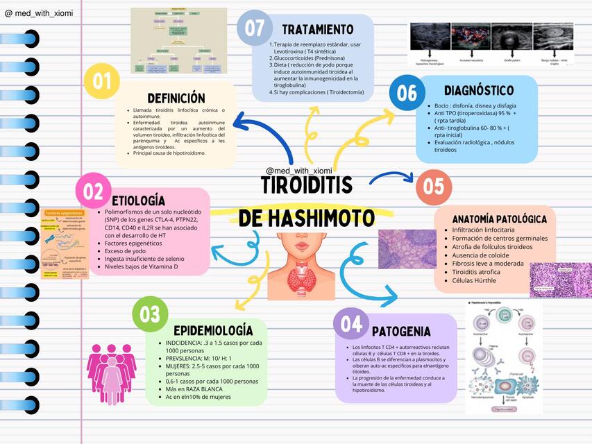 TIROIDITIS DE HASHIMOTO