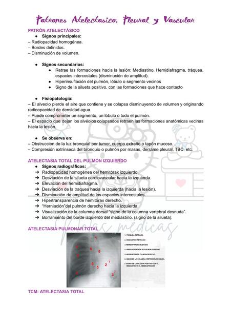 Patrones atelectásico, pleural y vascular