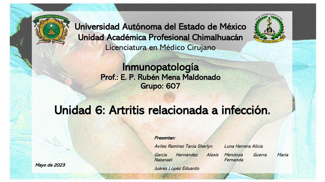 Artritis relacionada a infección