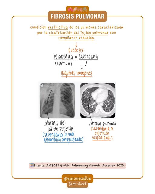 Fibrosis Quística