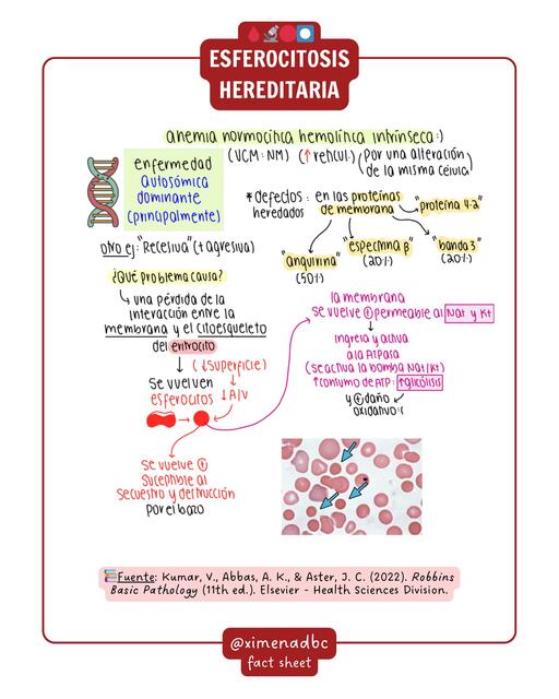 Esferocitosis hereditaria