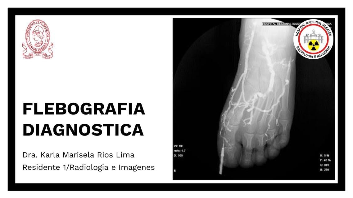 FLEBOGRAFIA DIAGNOSTICA | Karla | uDocz