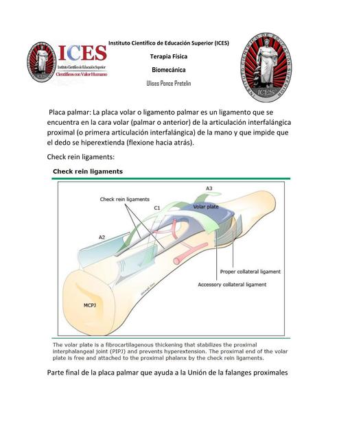 Biomecanica: Placa palmar y check rein