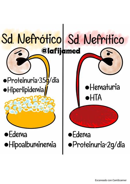 SÍNDROME NEFRÓTICO Y SÍNDROME NEFRÍTICO