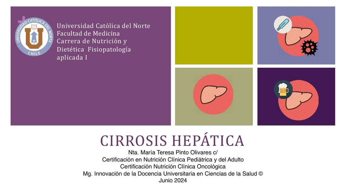 2 Cirrosis Hepática