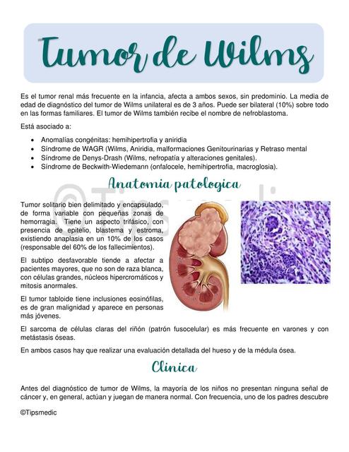 Tumor De Wilms Tips Medic Udocz