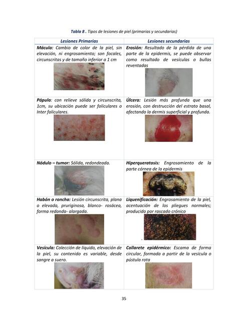 Tipos de lesiones de piel Primarias y secundarias