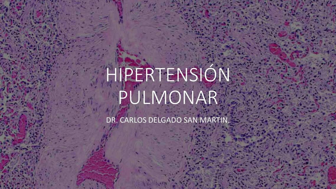 10 Hipertensión pulmonar