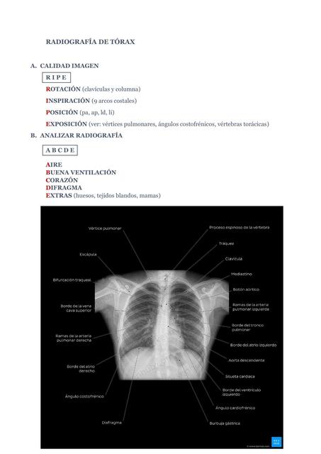 RADIOGRAFÍA DE TÓRAX UBICACIONES