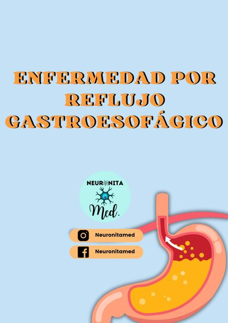 ENFERMEDAD POR REFLUJO GASTROESOFÁGICO