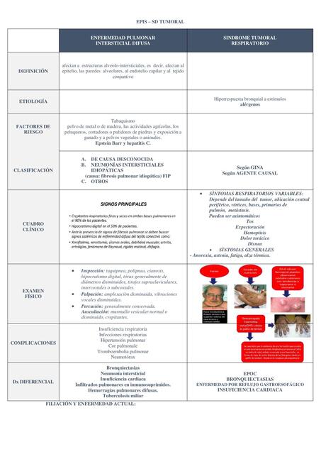 RESPIRATORIO: EPIS – SD TUMORAL