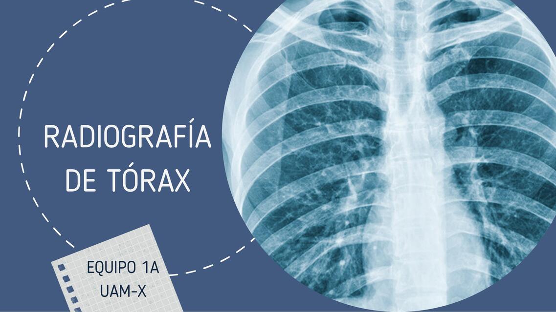 Lectura de Rx | Alejandra | uDocz