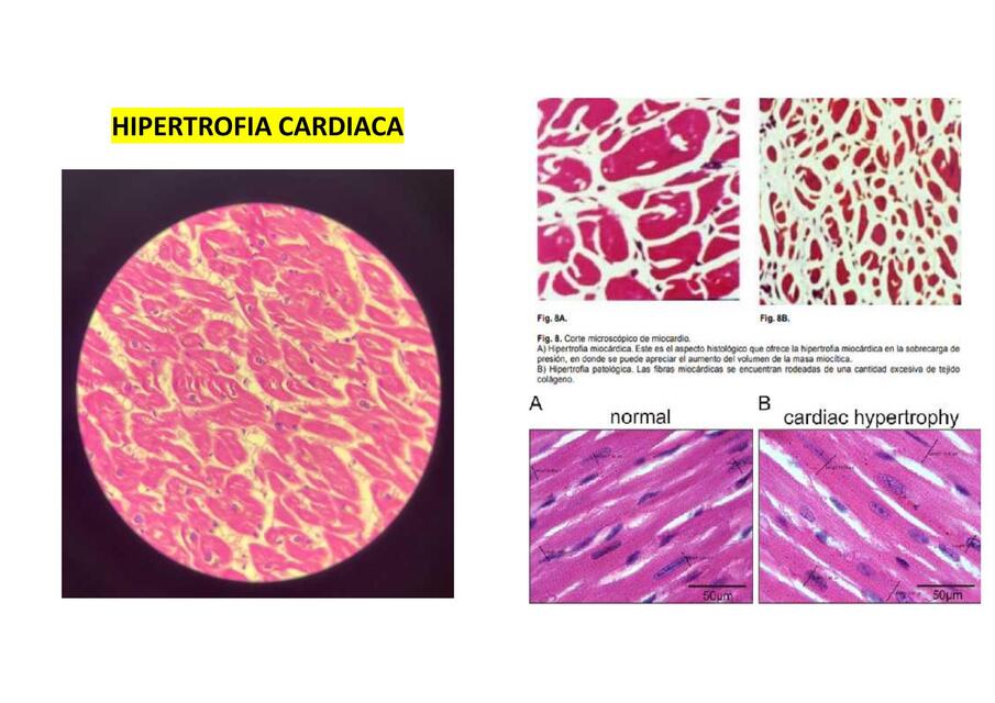 IMAGENES HISTOLOGICAS 1 PATOLOGIA