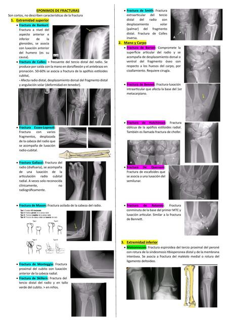 EPONIMOS DE FRACTURAS