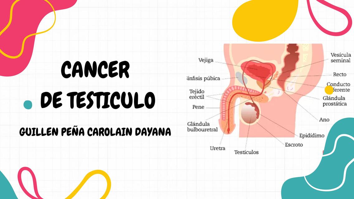 CANCER DE TESTICULO