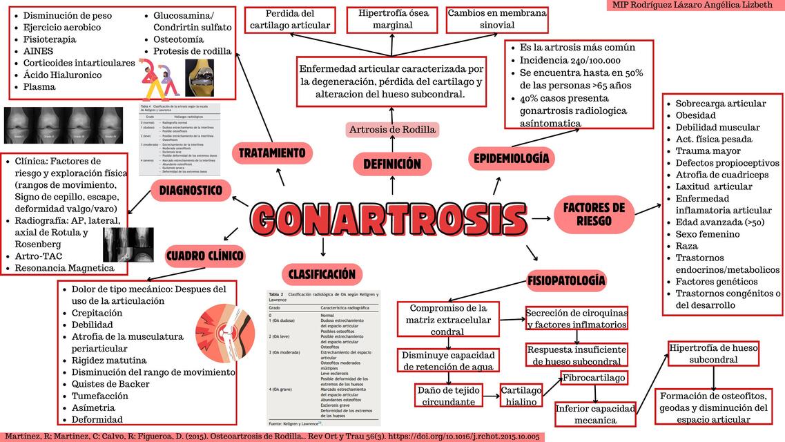 GONARTROSIS